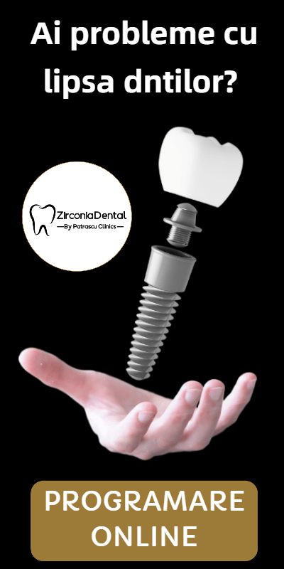 impant dentar craiova