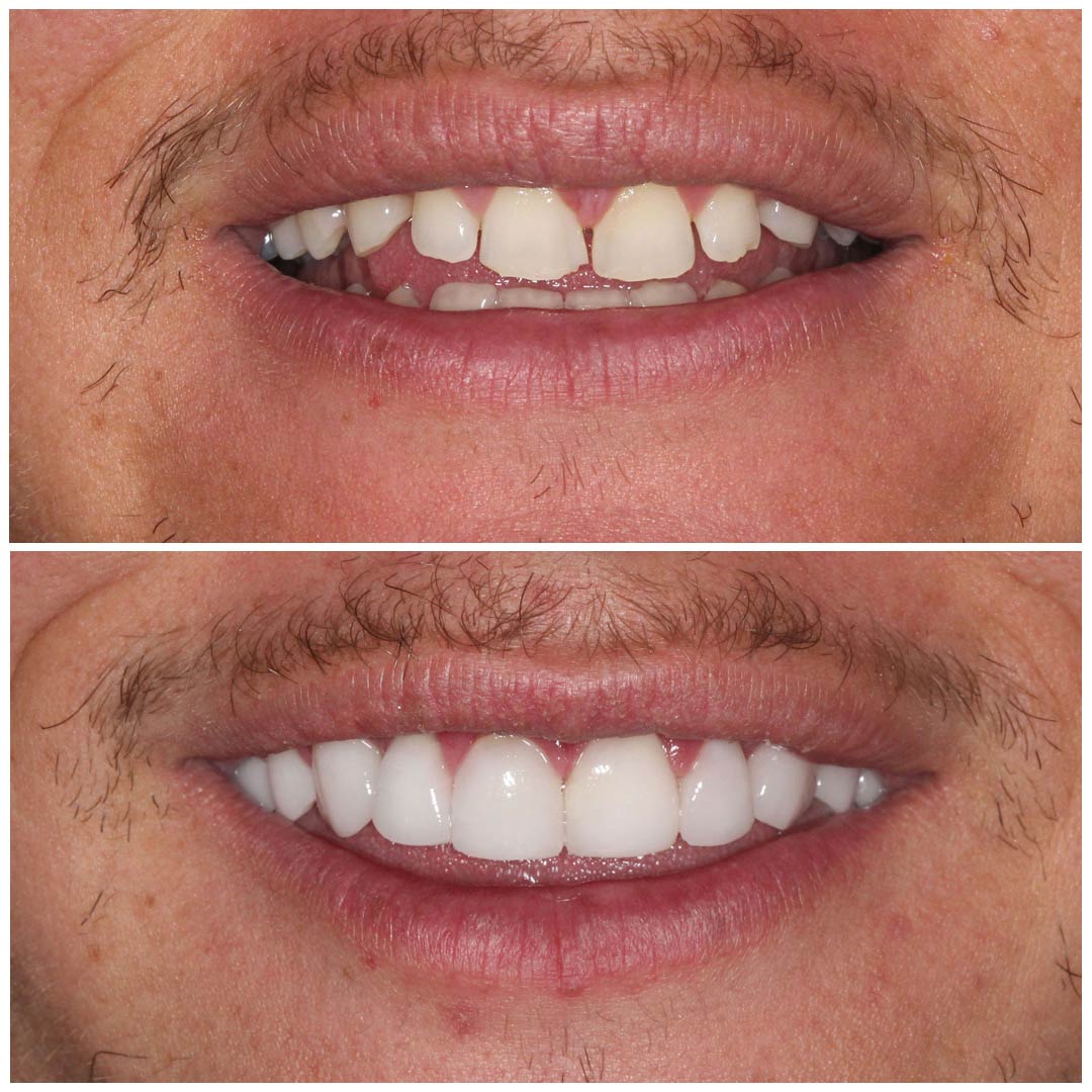 estetica dentara craiova